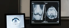 Digitalisasi Radiologi rumah sakit. Tantangan, manfaat dan solusinya.
