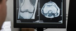PACS Radiologi: mengubah cara kerja RS